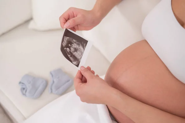 顔のない妊婦は白いソファに座って胎児の超音波写真を保持します — ストック写真