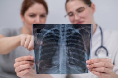 Doktor beyaz bir kadına danışıyor ve akciğerlerin röntgenleri hakkında yorum yapıyor.