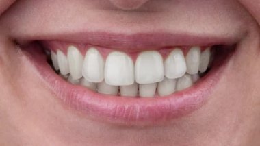 Close-up of a womans smile. White teeth gradually turn yellow