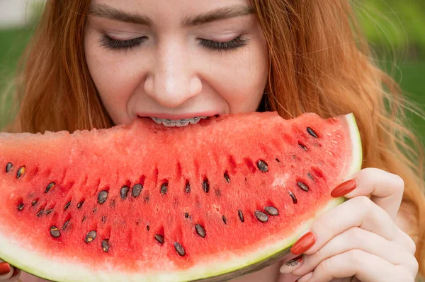 Close Portrait Red Haired Young Woman Braces Eating Watermelon Outdoors — Stock Photo, Image