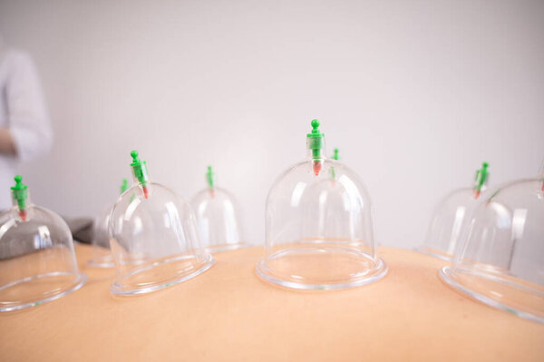 Женский массажист использует вакуумные банки на спине пациентов