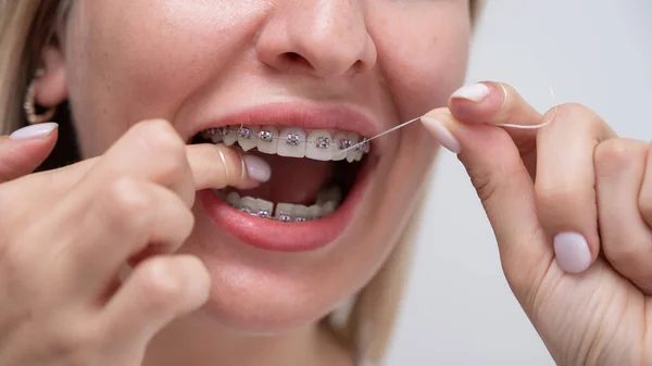 Caucasian Woman Cleaning Her Teeth Braces Using Dental Floss Cropped — 스톡 사진