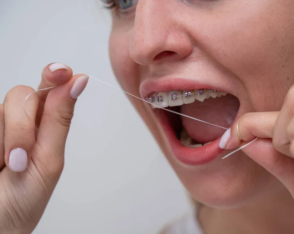 Caucasian Woman Cleaning Her Teeth Braces Using Dental Floss Cropped — 스톡 사진