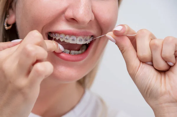 Caucasian Woman Cleaning Her Teeth Braces Using Dental Floss Cropped — Stock Photo, Image