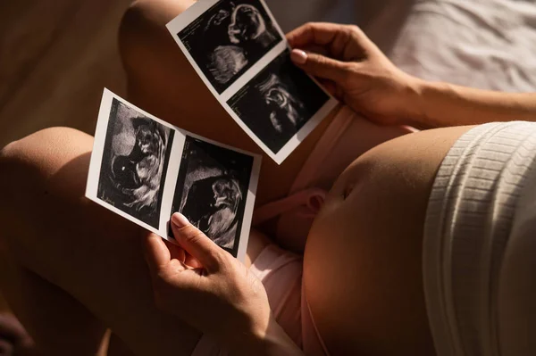 Hamile Bir Kadın Yatakta Otururken Ultrasondan Çekilen Fotoğrafa Bakar Hamile — Stok fotoğraf