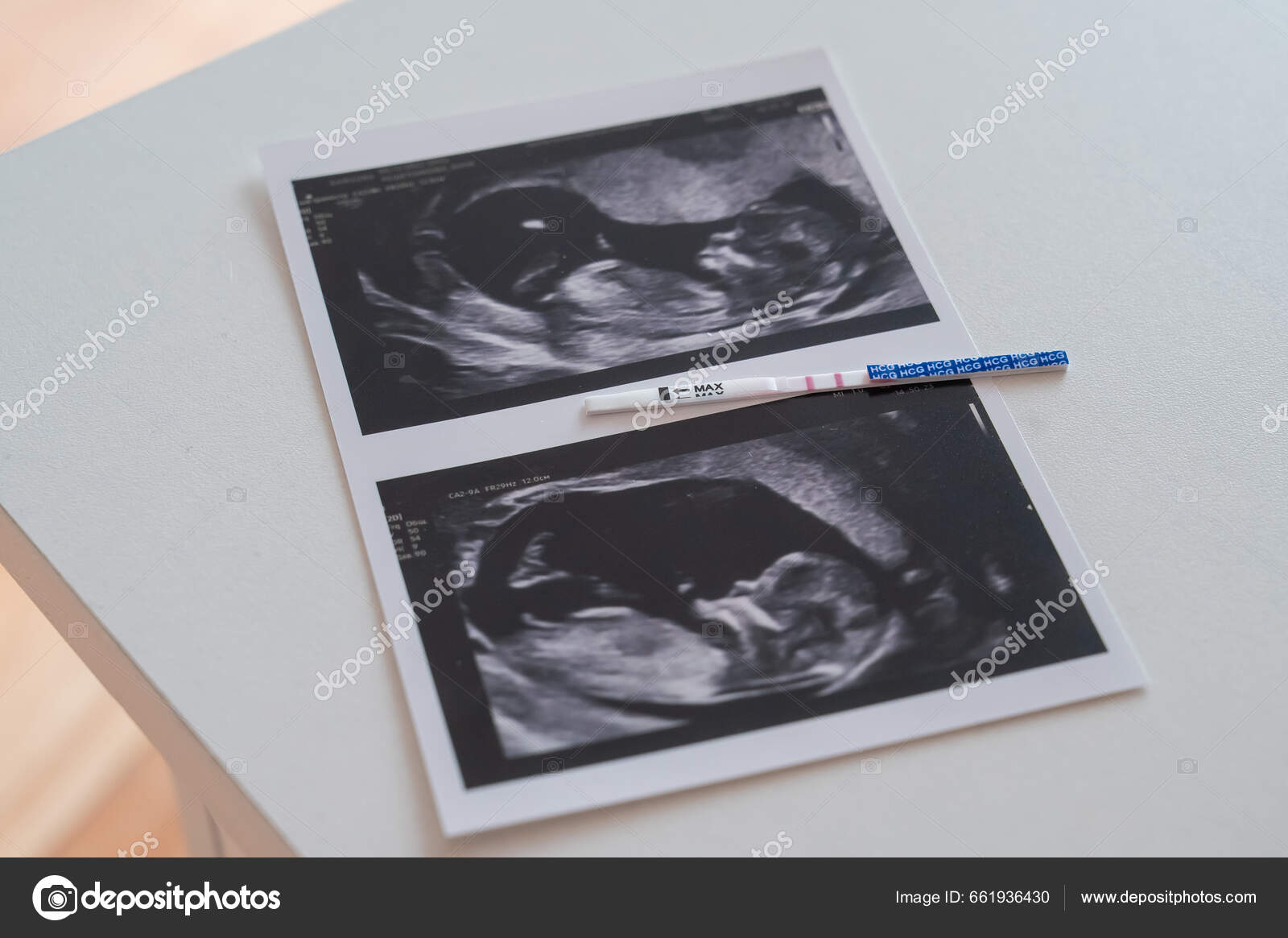 Prueba de embarazo positiva y ultrasonido negativo shop