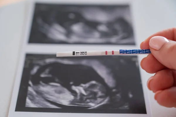 超音波で写真の背景に正の妊娠検査をしている女性 — ストック写真