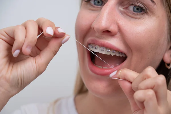 Běloška Čištění Zubů Rovnátka Pomocí Zubní Nitě — Stock fotografie