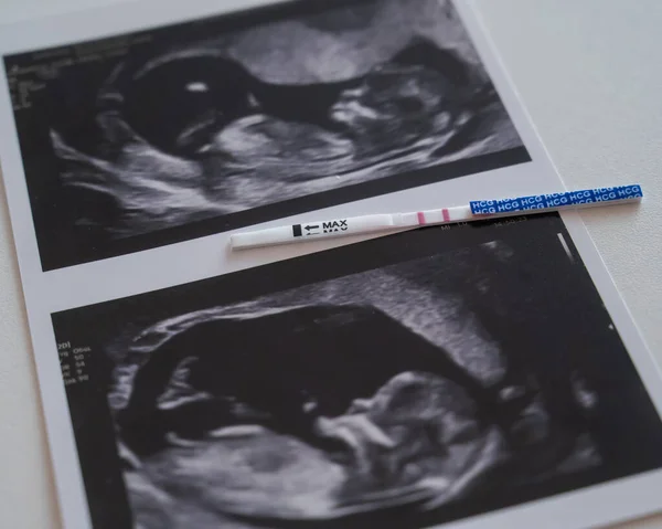 白いテーブルの上の超音波からの写真の正の妊娠検査 — ストック写真