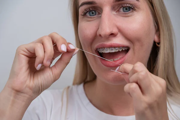 Λευκή Γυναίκα Που Καθαρίζει Δόντια Της Σιδεράκια Χρησιμοποιώντας Οδοντικό Νήμα — Φωτογραφία Αρχείου