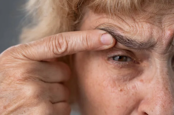 stock image Close-up portrait of an old woman pointing at a wrinkle on her upper eyelid