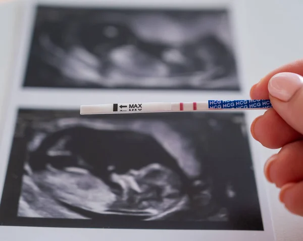 Woman holding a positive pregnancy test on the background of a photo with an ultrasound