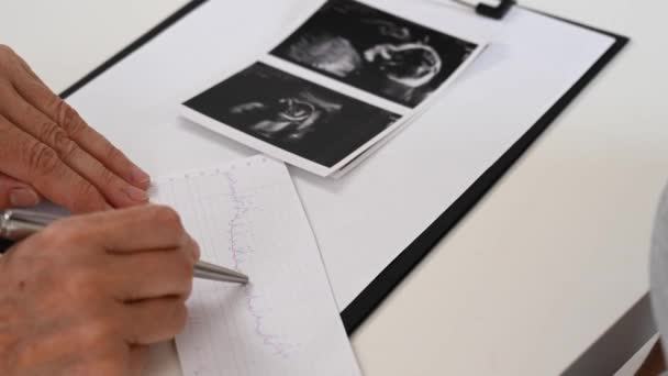 Γιατρός Εξετάζει Την Εμβρυϊκή Καρδιοκογραφία — Αρχείο Βίντεο