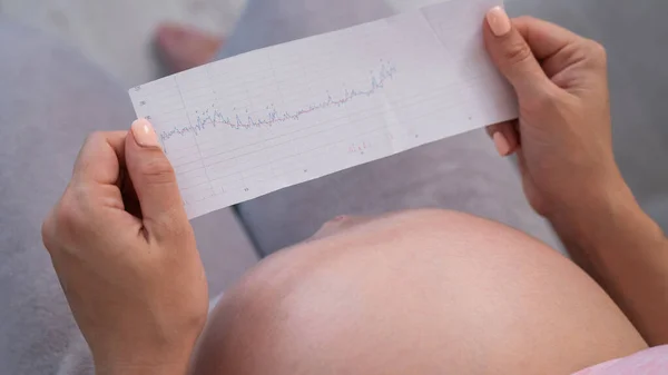 Een Zwangere Vrouw Kijkt Naar Resultaten Van Cardiotocografie Terwijl Bank — Stockfoto