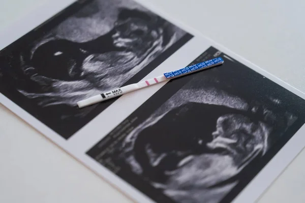 Positive pregnancy test in a photo from an ultrasound on a white table