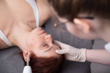 Doktor, kadın bir hastanın yüzündeki sivilce için darsonval aparatı kullanıyor.