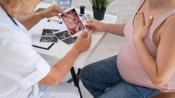 Porodník Gynekolog Vysvětlující Screening Obrazu Těhotné Ženě — Stock fotografie