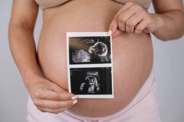 Hamile bir kadın, karnının arka planında ultrason görüntülerinden bir fotoğraf tutuyor.