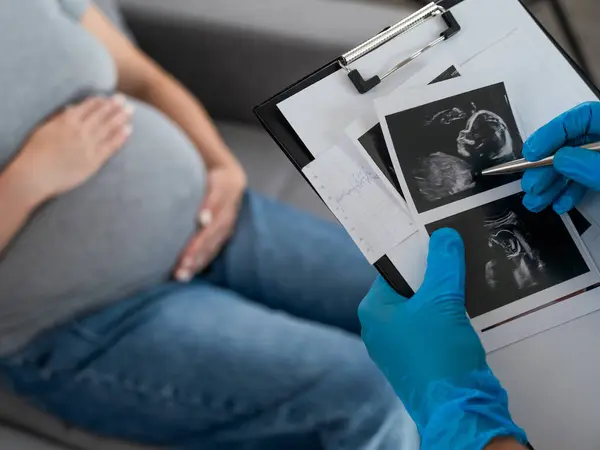 Gynekolog Podívá Ultrazvuk Těhotné Ženy — Stock fotografie