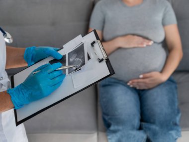 Jinekolog hamile bir kadının ultrasonuna bakıyor.