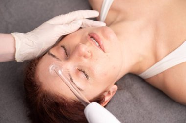 Doktor, kadın bir hastanın yüzündeki sivilce için darsonval aparatı kullanıyor.