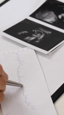 Doktor fetal kardiyografiye bakıyor. Dikey video