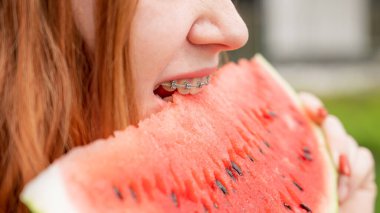Diş telleri açık havada karpuz yiyen kızıl saçlı genç kadının yakın plan portresi..