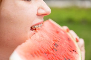 Diş telleri açık havada karpuz yiyen kızıl saçlı genç kadının yakın plan portresi..