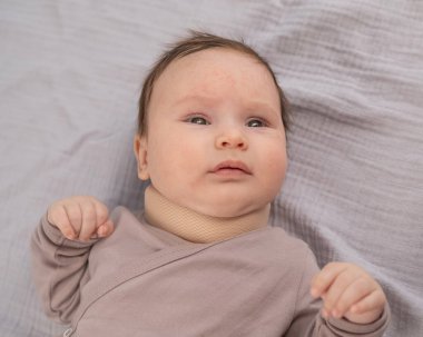 Top view of a newborn baby wearing an orthopedic collar clipart