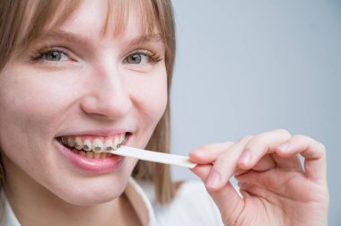 Dişlerinde metal diş teli olan genç bir kadın sakız çiğniyor. Kız şekerleme yiyor..