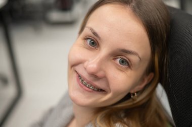 Dişlerinde diş teli olan beyaz kadın ofiste çalışıyor.