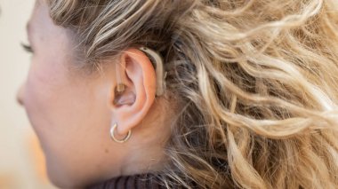 Kafkasyalı genç bir kadının kulağına yakın plan işitme cihazı takılmış.