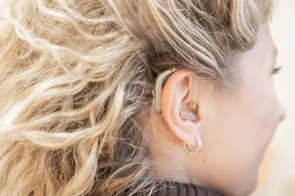 Kafkasyalı genç bir kadının kulağına yakın plan işitme cihazı takılmış.