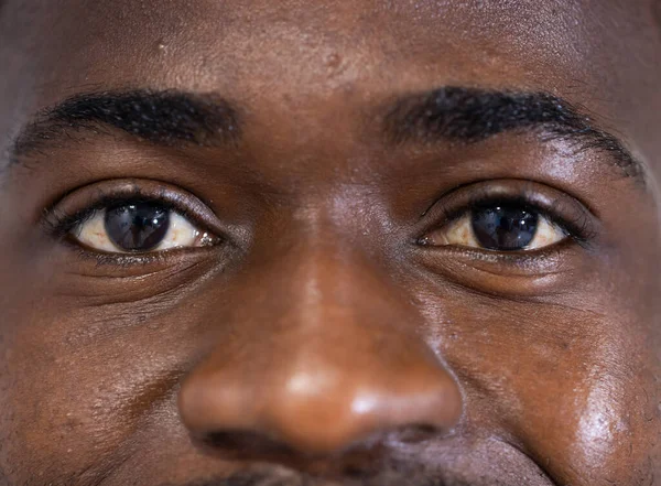 Retrato Inalterado Los Ojos Del Feliz Médico Afroamericano Sonriendo Satisfacción —  Fotos de Stock