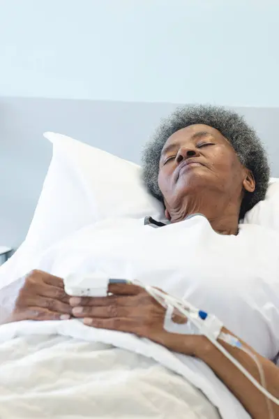 African american senior female patient sleeping in bed in sunny hospital room. Medicine, healthcare and medical services, unaltered.