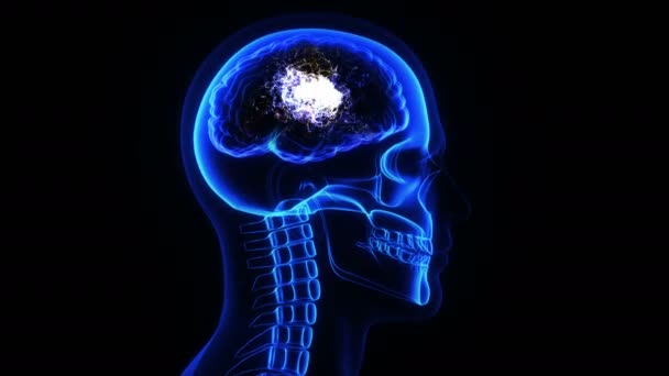 Animacja Ludzkiej Głowy Czaszki Aktywności Elektrycznej Mózgu — Wideo stockowe