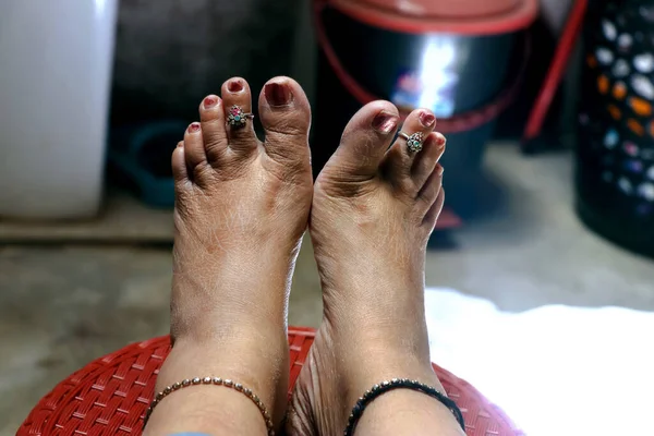 Eine Nahaufnahme Der Rauen Nackten Füße Einer Inderin Selektiver Fokus — Stockfoto