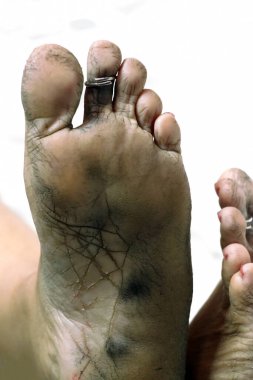 Yüksek çözünürlüklü yakın çekim görüntüsü kuru, çatlak topuklar ve çıplak ayak tabanları, cilt dokusu ve ayak bakımı sorunları vurgulanıyor.