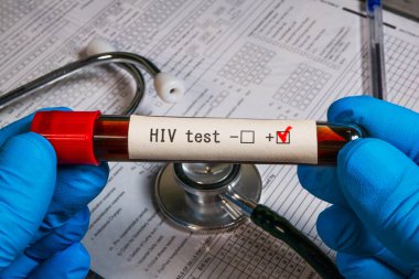 Eldivenli eller, kan içeren bir test tüpü tutuyor. Stetoskop ve tıbbi çizelge ile HIV testi pozitif sonuç veriyor.