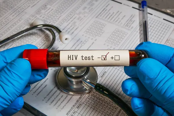 Doktor mavi eldiven takıyor. Elinde HIV testi sonucu negatif olan bir test tüpü ve steteskop tutuyor.