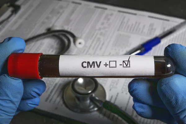 Doktor mavi eldiven giyip elinde kan testi tüpü tutuyor. Negatif CMV test sonuçları, tıbbi çizelge ve arka planda steteskop var.