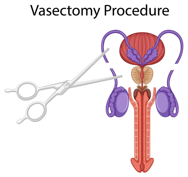 Male Reproductive System Illustration — Vetor de Stock