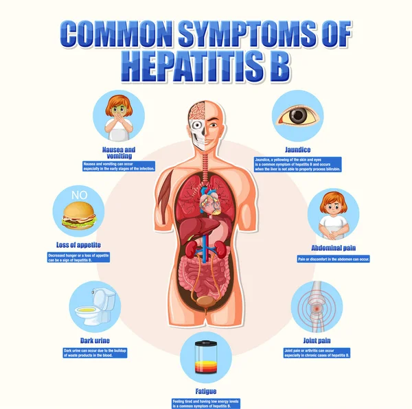 Informative Poster Common Symptoms Hepatitis Illustration — Stock Vector