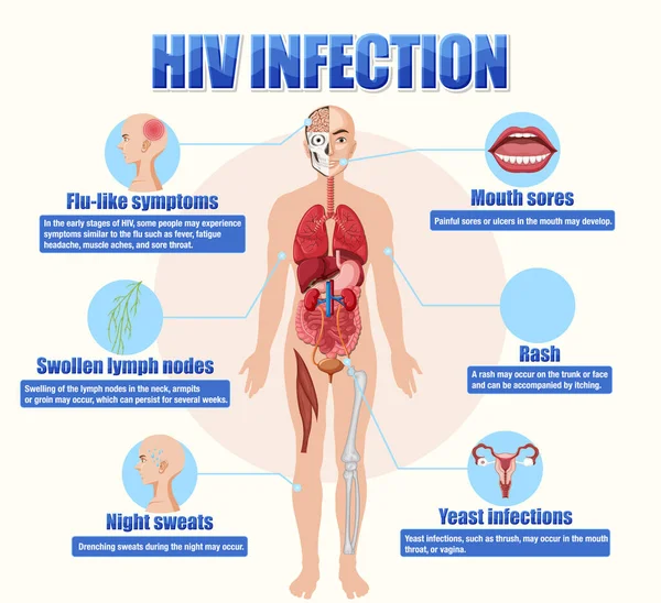 Manifesto Informativo Illustrazione Dell Infezione Hiv — Vettoriale Stock