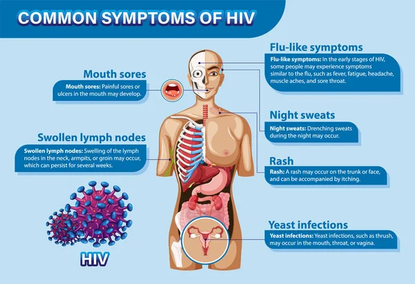 Informatives Poster Den Häufigsten Symptomen Von Hiv — Stockvektor