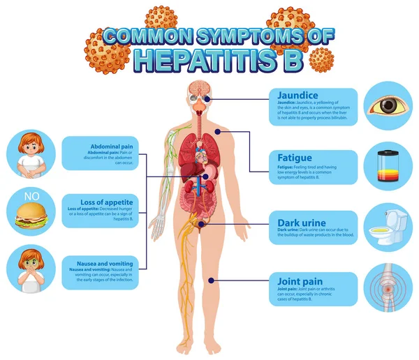 Cartaz Informativo Dos Sintomas Comuns Ilustração Hepatite — Vetor de Stock
