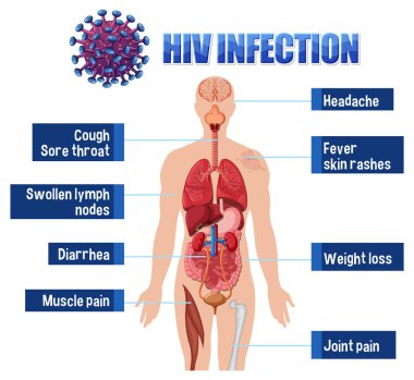 HIV enfeksiyonu illüstrasyonunun bilgilendirici posteri