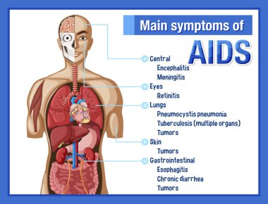 AIDS illüstrasyonunun ana simgelerinin bilgilendirici posteri