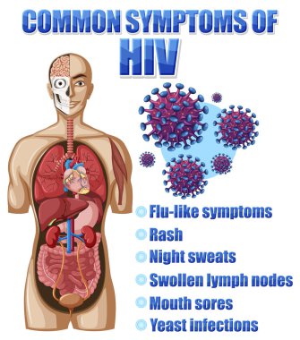 HIV illüstrasyonunun yaygın belirtilerinin bilgilendirici posteri