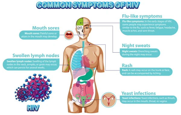 Cartaz Informativo Dos Sintomas Comuns Ilustração Hiv — Vetor de Stock